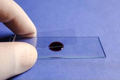 Smeared onto a glass slide